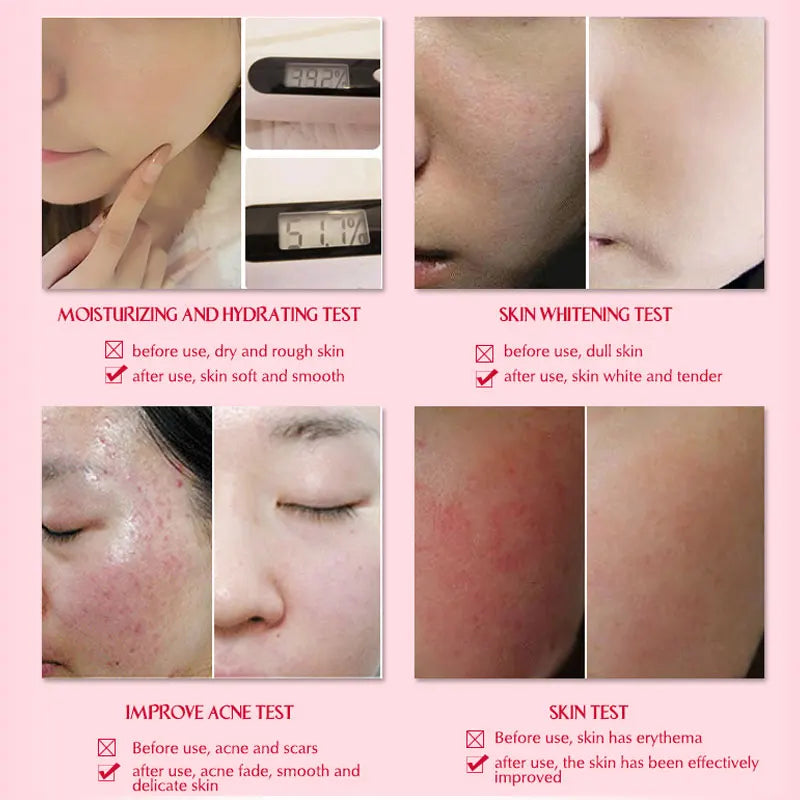 ARTISCARE Snail Serum 3pcs Moisturizing Repair Face Brighten Hydrating Aging Acne Treatment Blackhead Face Cream