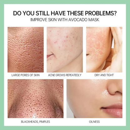 Tea Tree Face Masks Oil Control Shrink Enlarged Pores Blackhead Remover Nourishing Facial Cleansing Clay Mask Skin Care Beauty