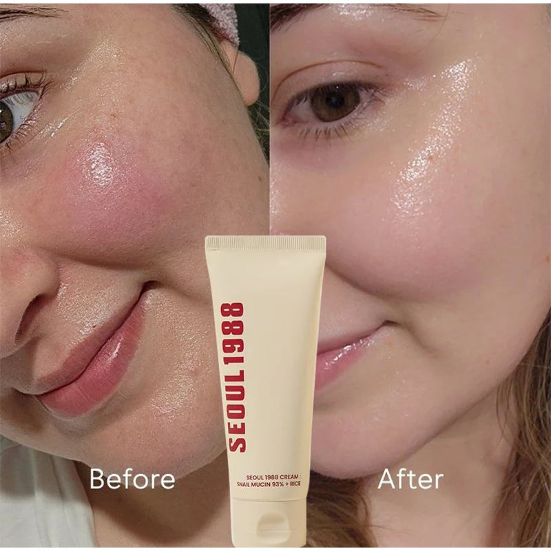 Seoul 1988 Niacinamide Cream 100ml Retinol 2% Ginseng Essence Firming Eye Cream Brightening Deep Moisturizing Care Essence Set