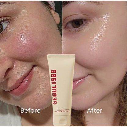 Seoul 1988 Niacinamide Cream 100ml Retinol 2% Ginseng Essence Firming Eye Cream Brightening Deep Moisturizing Care Essence Set