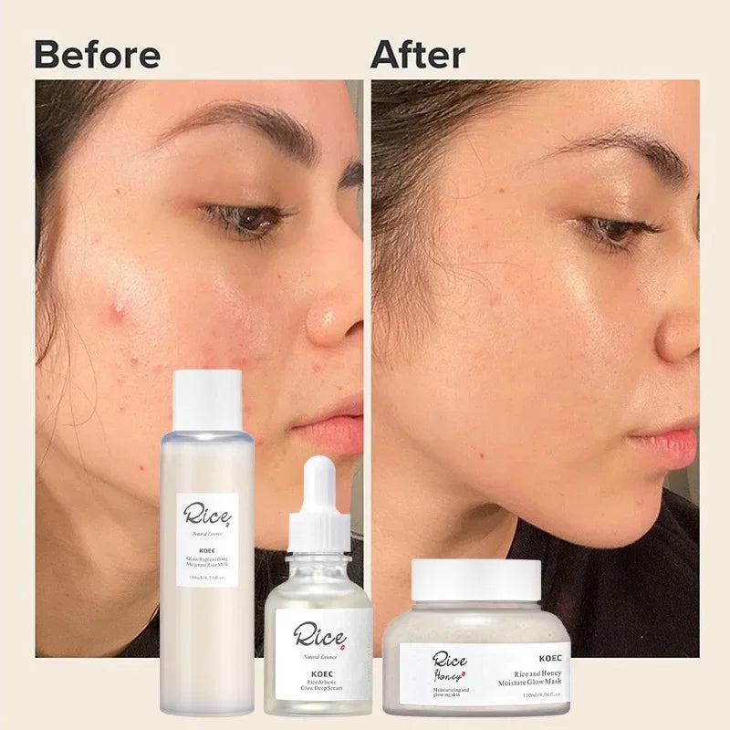 Rice Extract Deep Moisturizing Koec Rice Honey Facial Care Set Face Cream Serum Toner Facial Smear Mask Whiten Eye Cream Product