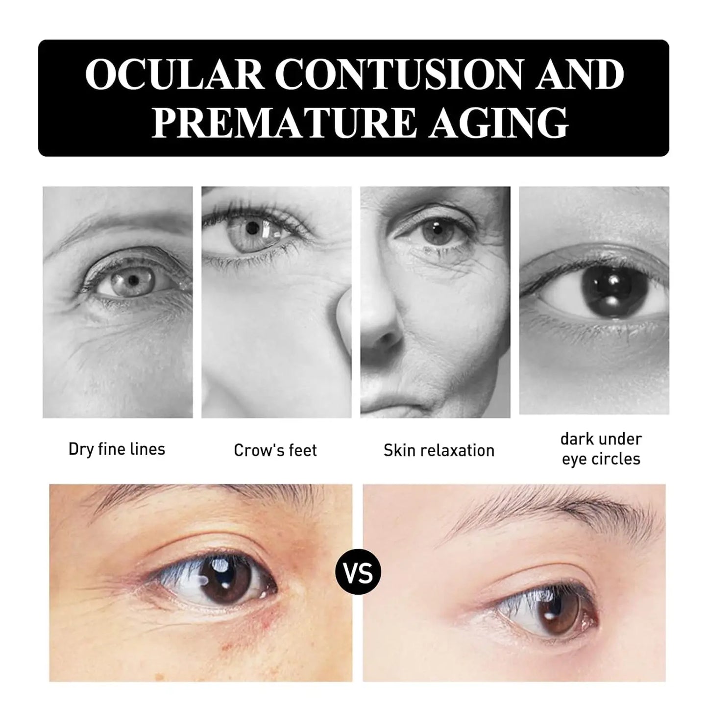 2Pcs Verfons 30G Snake Venom Peptide Eye Cream Smoothes Fine Lines And Dark Eye Cream Instant Removal Of Eye Bags Cream