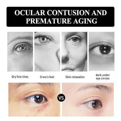 2Pcs Verfons 30G Snake Venom Peptide Eye Cream Smoothes Fine Lines And Dark Eye Cream Instant Removal Of Eye Bags Cream