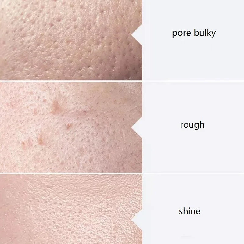 Skincare Face Serum Hydro Facial Aqua Peel Solution 400ml AS1 SA2 AO3 For  Machine Skin Deep Cleaning