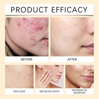 Rice Extract Deep Moisturizing Koec Rice Honey Facial Care Set Face Cream Serum Toner Facial Smear Mask Whiten Eye Cream Product