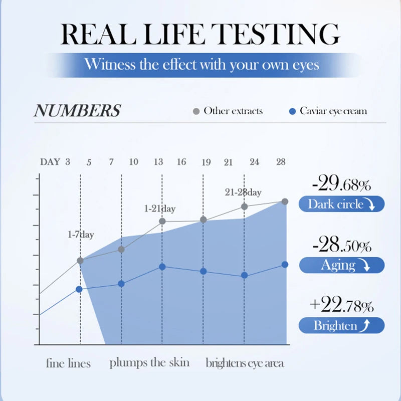 SADOER Caviar Hyaluronic Acid Eye Cream Anti Dark Circles Removal Eyes Bags Firming Moisturizing Beauty Eyes Skin Care Products