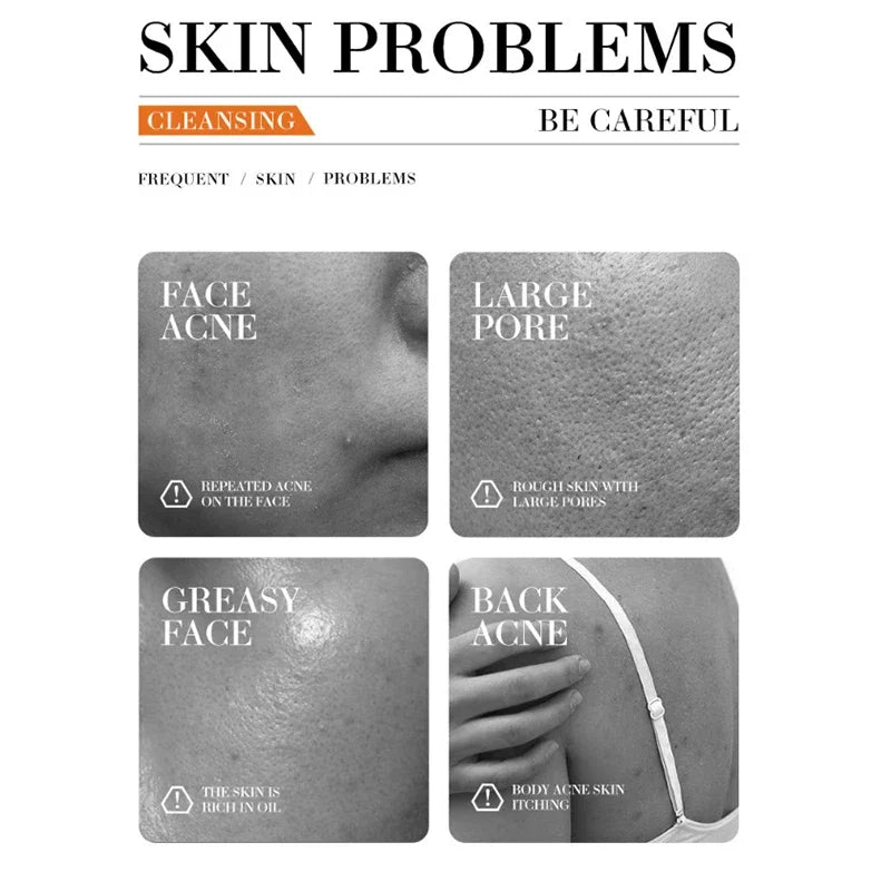 Turmeric Soap Handmade Face Soap Tender Skincare Beauty Body Cleaning Lightening Dark Underarm Leg Body Cleansers Brightening