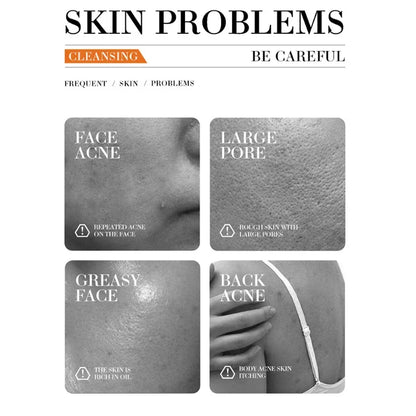 Turmeric Soap Handmade Face Soap Tender Skincare Beauty Body Cleaning Lightening Dark Underarm Leg Body Cleansers Brightening